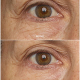 Chebula Multi-Corrective Eye Patches