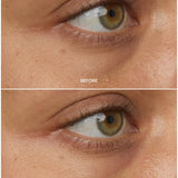 Chebula Multi-Corrective Eye Patches