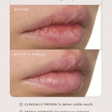 Pure Radiance Overnight Lip Treatment