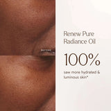 Renew Pure Radiance Oil