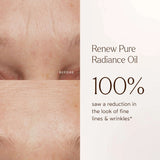 Renew Pure Radiance Oil